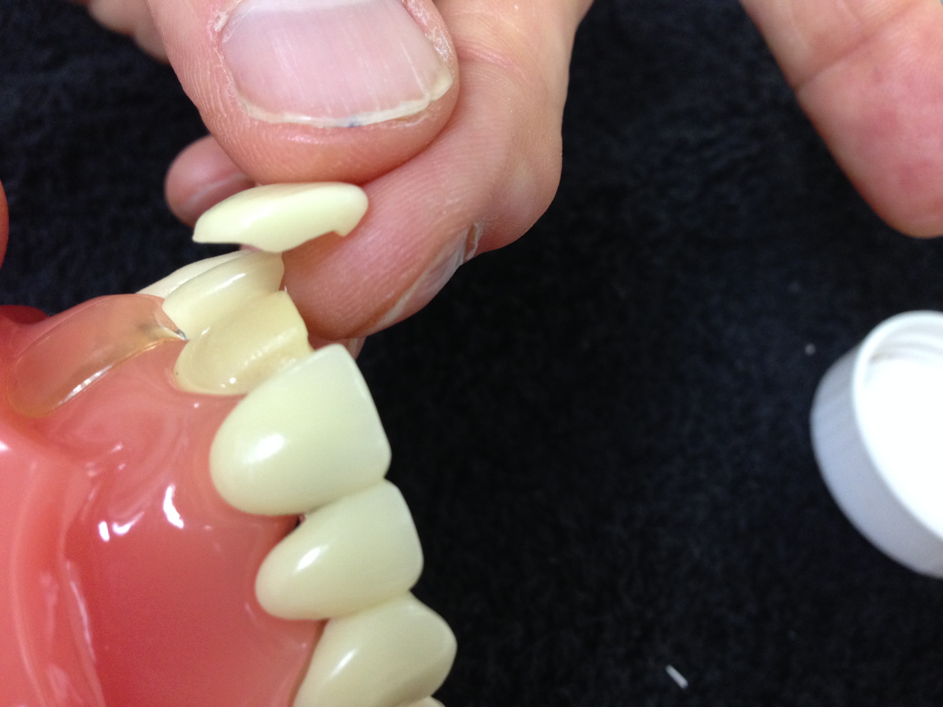 Veneers And Lumineers